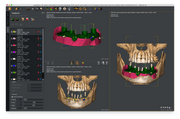 QUICKVISION 3D – Dental Implant Planning Software
