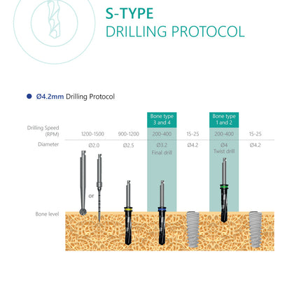 S-Type Implant