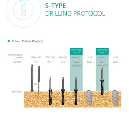 S-Type Implant