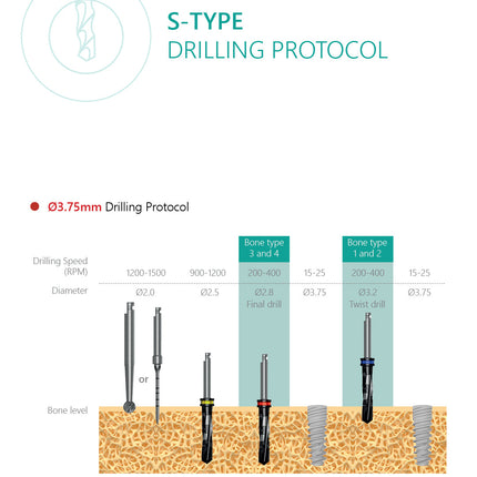 S-Type Implant