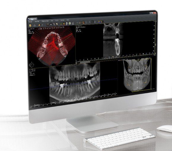 QUICKVISION 3D – Dental Implant Planning Software