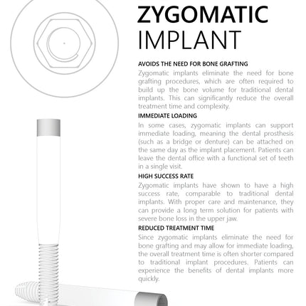 Zygomatic Implant