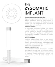 Zygomatic Implant