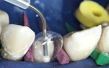 Dental Posterior Transparent Crowns Matrices Matrix 64 pcs. TOR VM 1.911