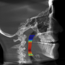 Free 1 month unlimited use With ORCA's AI 3D Segmentation analysis from any CBCT scans!